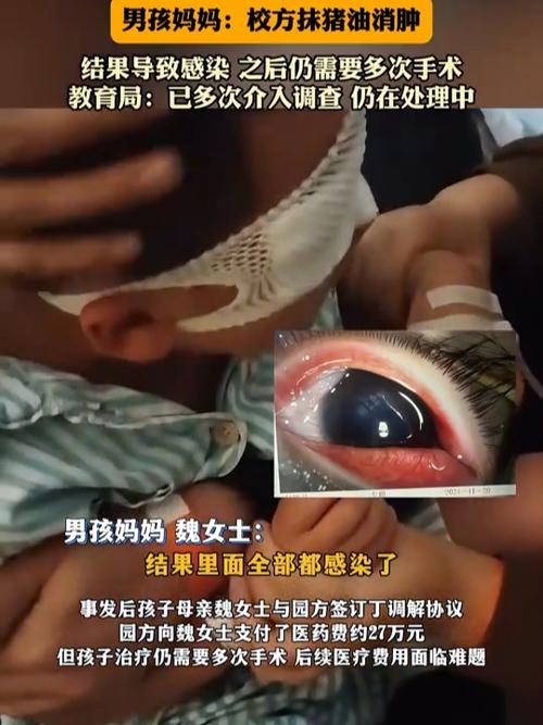 早教中心幼儿伤害案例