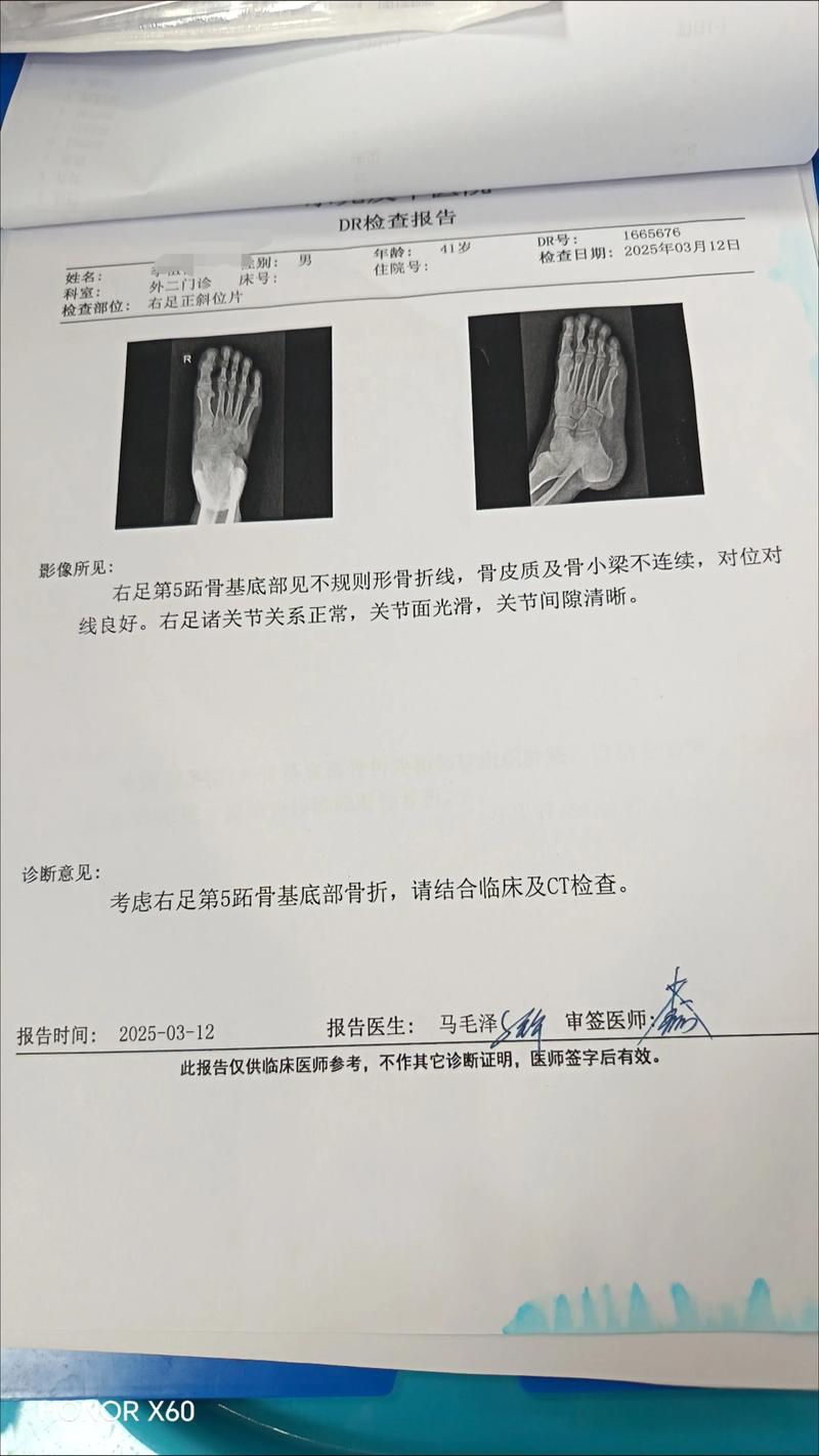 脚骨折作文600字初中